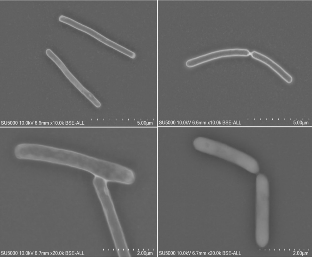 L’UCAD DÉCOUVRE UNE NOUVELLE ESPÈCE BACTÉRIENNE AUX PERSPECTIVES PROMETTEUSES CONTRE LA MALNUTRITION INFANTILE